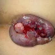 Illustration for article titled obat wasir ampuh
